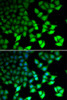 Epigenetics and Nuclear Signaling Antibodies 2 Anti-KDM4B Antibody CAB5824