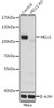 KO Validated Antibodies 1 Anti-HELLS Antibody CAB5831KO Validated