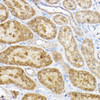Cell Biology Antibodies 9 Anti-RPL4 Antibody CAB5886