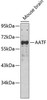 Epigenetics and Nuclear Signaling Antibodies 2 Anti-AATF Antibody CAB5896