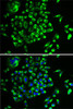 Cell Biology Antibodies 9 Anti-MRPL28 Antibody CAB5897