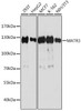 Immunology Antibodies 2 Anti-MATR3 Antibody CAB5905