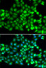 Cell Death Antibodies 2 Anti-TRIM69 Antibody CAB5910
