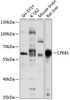 Epigenetics and Nuclear Signaling Antibodies 2 Anti-CPEB1 Antibody CAB5913