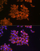 Epigenetics and Nuclear Signaling Antibodies 2 Anti-ETF1 Antibody CAB5920