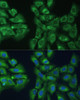 Immunology Antibodies 2 Anti-EIF3D Antibody CAB5947