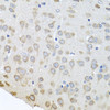 Cell Biology Antibodies 9 Anti-PABPC4 Antibody CAB5948