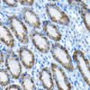 Cell Biology Antibodies 9 Anti-MRPL13 Antibody CAB5979