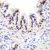 Immunology Antibodies 2 Anti-ALYREF Antibody CAB6010
