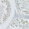 Cell Biology Antibodies 16 Anti-PIWIL-2 Antibody CAB6044