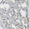 Epigenetics and Nuclear Signaling Antibodies 2 Anti-PRPF4 Antibody CAB6052