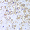 Cell Biology Antibodies 9 Anti-RPS10 Antibody CAB6056