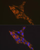 Cell Biology Antibodies 9 Anti-RPS6 Antibody CAB6058