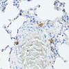 Cell Death Antibodies 2 Anti-TIAL1 Antibody CAB6075