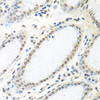 KO Validated Antibodies 1 Anti-HuR / ELAVL1 Antibody CAB6089KO Validated