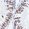 Epigenetics and Nuclear Signaling Antibodies 2 Anti-IGF2BP3 Antibody CAB6099