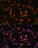 Cell Biology Antibodies 9 Anti-CSF2 Antibody CAB6127