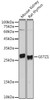 Metabolism Antibodies 2 Anti-GSTZ1 Antibody CAB6129