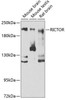 Immunology Antibodies 2 Anti-RICTOR Antibody CAB6131