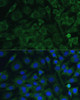 Developmental Biology Anti-OSM Antibody CAB6163