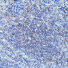 Cell Biology Antibodies 10 Anti-CSF3 Antibody CAB6178