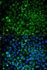 Metabolism Antibodies 2 Anti-COMT Antibody CAB6200