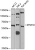 Cell Cycle Antibodies 1 Anti-PPM1D Antibody CAB6204