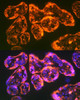 Cell Biology Antibodies 10 Anti-ITGA5 Antibody CAB6209