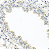Cell Biology Antibodies 10 Anti-IL-22 Antibody CAB6216