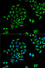 Metabolism Antibodies 2 Anti-CYP2C9 Antibody CAB6219