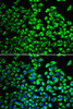 Cell Biology Antibodies 10 Anti-GIP Antibody CAB6230