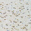 Cell Death Antibodies 2 Anti-AKTIP Antibody CAB6239