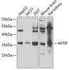 Cell Death Antibodies 2 Anti-AKTIP Antibody CAB6239