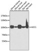 Cell Biology Antibodies 10 Anti-AOC1 Antibody CAB6249