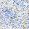 Cell Cycle Antibodies 1 Anti-CHAF1B Antibody CAB6259