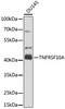 Cell Death Antibodies 2 Anti-TNFRSF10A Antibody CAB6267