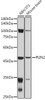 Cell Biology Antibodies 10 Anti-PLIN2 Antibody CAB6276