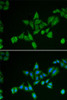Cell Death Antibodies 2 Anti-BNIP2 Antibody CAB6282
