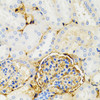 Metabolism Antibodies 2 Anti-GALT Antibody CAB6292