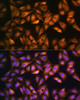 Metabolism Antibodies 2 Anti-SOAT1 Antibody CAB6311