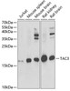 Cell Biology Antibodies 10 Anti-TAC3 Antibody CAB6312