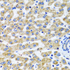 Cell Biology Antibodies 10 Anti-SERPINA7 Antibody CAB6313