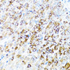 Cell Biology Antibodies 10 Anti-SERPINA7 Antibody CAB6313