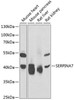 Cell Biology Antibodies 10 Anti-SERPINA7 Antibody CAB6313