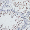 Cell Death Antibodies 2 Anti-NOL3 Antibody CAB6319