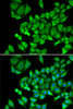Metabolism Antibodies 2 Anti-DHRS9 Antibody CAB6324