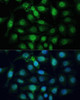 Cell Cycle Antibodies 1 Anti-ZWINT Antibody CAB6328