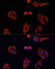 Cardiovascular Antibodies Anti-FAP Antibody CAB6349