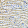 Immunology Antibodies 2 Anti-C4BPB Antibody CAB6362