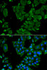 Developmental Biology Anti-DBN1 Antibody CAB6366